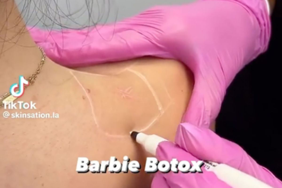 Foto colorida de uma aplicação de botox no pescoço - Metrópoles