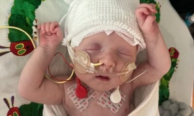 Bebê com doença rara é salvo por terapia genética Crispr inédita