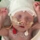 Bebê com doença rara é salvo por terapia genética Crispr inédita