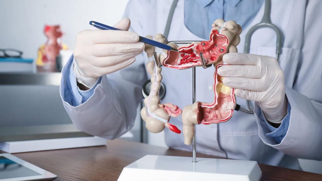 Médico apontando caneta para parte de dentro de maquete de intestino grosso